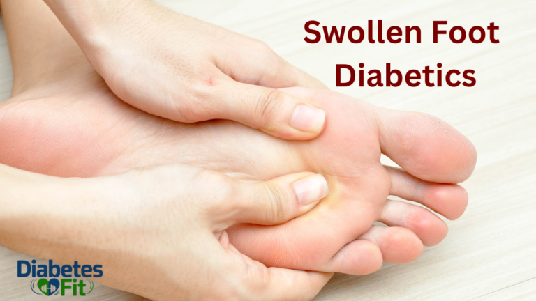 Swollen Foot in Diabetes: Causes, Symptoms, and Treatment