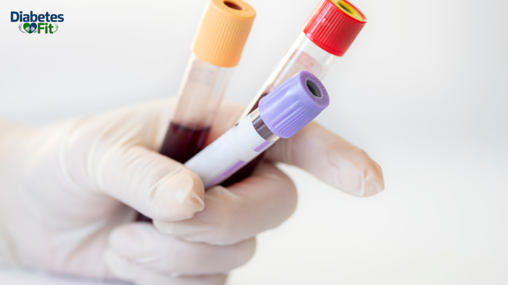 Dizziness is from Blood Sugar