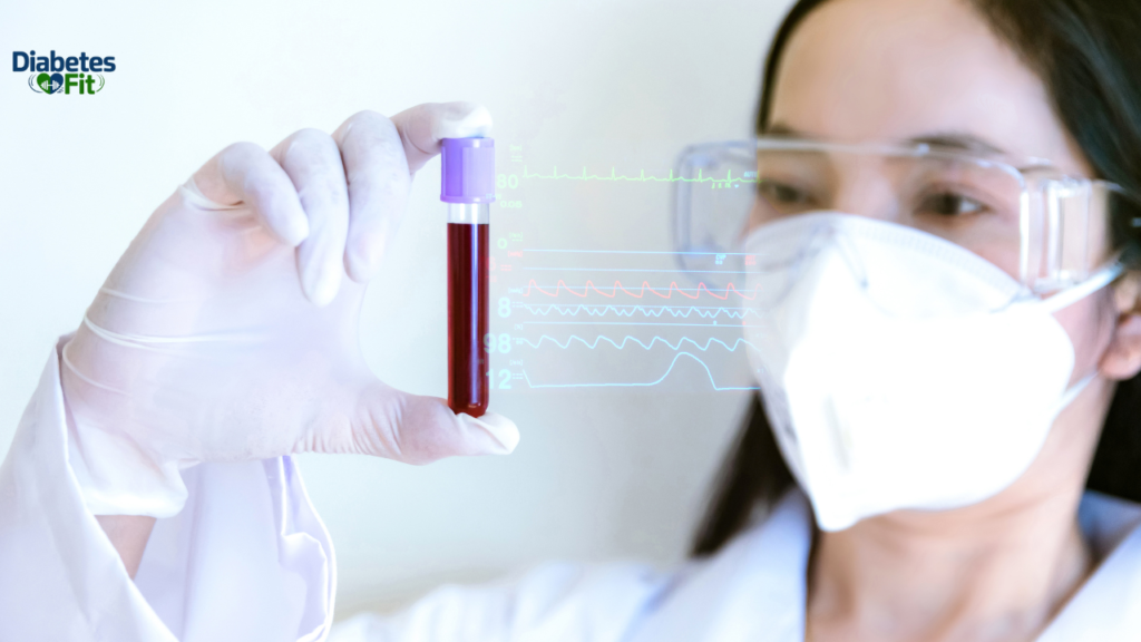 Does Yogurt Spike Blood Sugar?