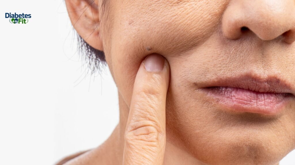 Benefits of Lemon Water