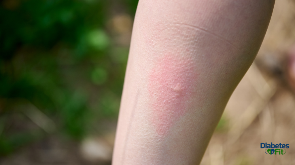 Is Sunscreen Bad for Your Skin?