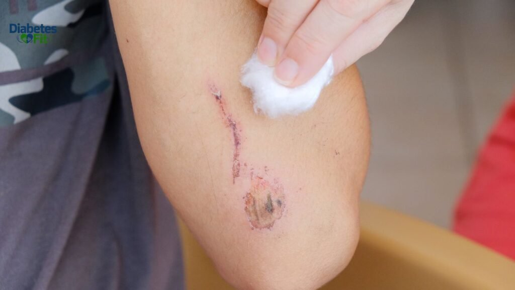 Coconut Oil for Skin